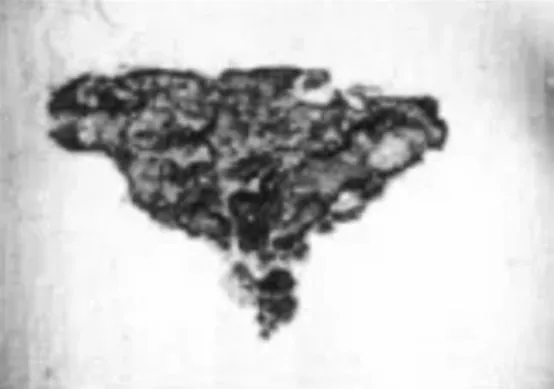 轴承“压力过大”，也会“变形抑郁”